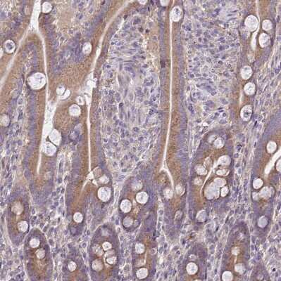 Immunohistochemistry-Paraffin: CEACAM18 Antibody [NBP2-32471]