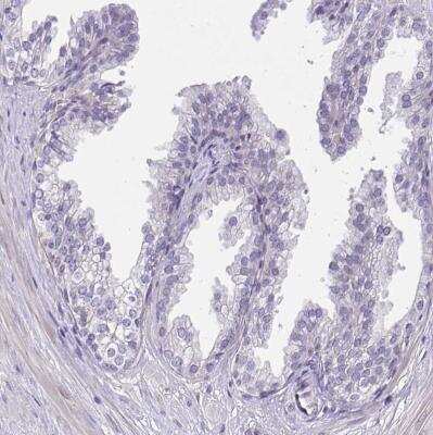 Immunohistochemistry-Paraffin: CEACAM18 Antibody [NBP2-32471]