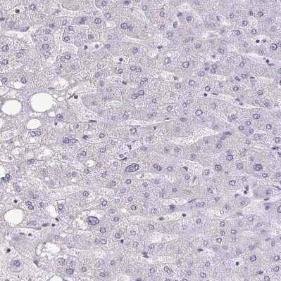 Immunohistochemistry-Paraffin: CEACAM18 Antibody [NBP2-32471]
