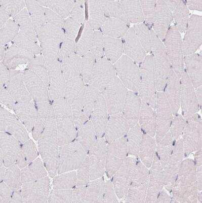 Immunohistochemistry-Paraffin: CEACAM18 Antibody [NBP2-32471]
