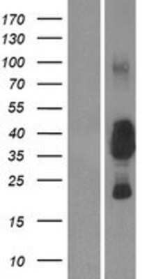 Western Blot: CEACAM19 Overexpression Lysate [NBP2-06675]