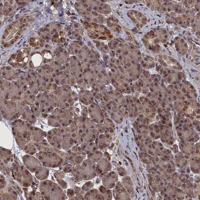 Immunohistochemistry-Paraffin: CEACAM21 Antibody [NBP1-82252]