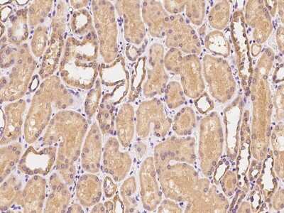 Immunohistochemistry-Paraffin: CEACAM21 Antibody [NBP2-97874]