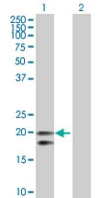 Western Blot: CEACAM21 Antibody [H00090273-D01P]