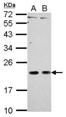 Western Blot: CEACAM21 Antibody [NBP2-15853]