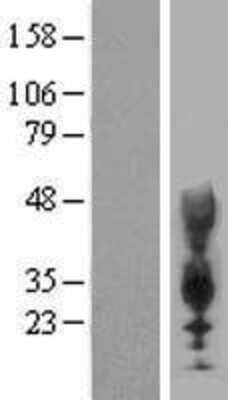 Western Blot: CEACAM21 Overexpression Lysate [NBP2-05874]