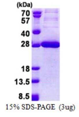 SDS-PAGE: Recombinant Human CEACAM21 His Protein [NBP2-22734]