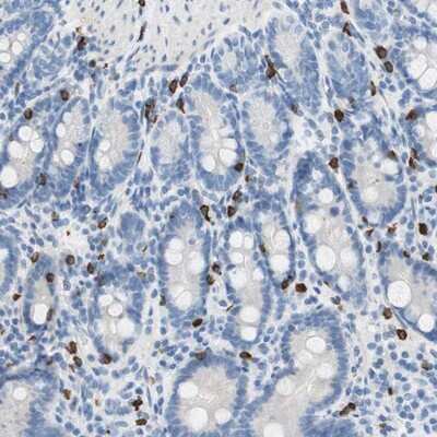 Immunohistochemistry-Paraffin: CEACAM1/CD66a Antibody [NBP1-85743]