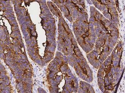 Immunohistochemistry-Paraffin: CEACAM3/CD66d Antibody [NBP2-99909]