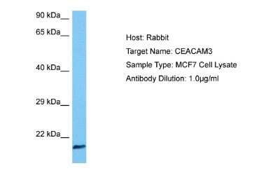 Western Blot: CEACAM3/CD66d Antibody [NBP2-88782]