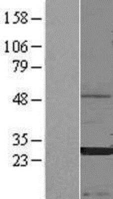 Western Blot: CEACAM3/CD66d Overexpression Lysate [NBP2-10774]