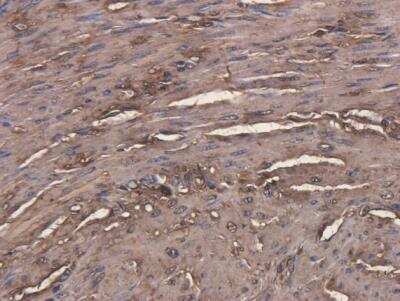 Immunohistochemistry: CEACAM5/CD66e Antibody (Arcitumomab) - Azide and BSA Free [NBP2-75904]