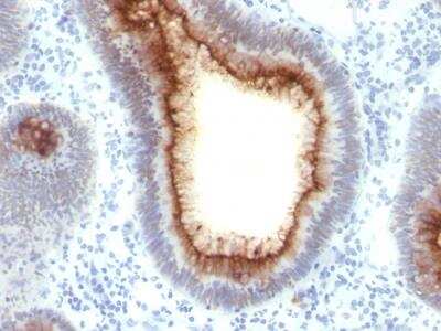 Immunohistochemistry-Paraffin: CEACAM5/CD66e Antibody (C66/1009) - Azide and BSA Free [NBP2-47976]