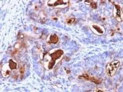 Immunohistochemistry-Paraffin: CEACAM5/CD66e Antibody (C66/1260) - Azide and BSA Free [NBP2-47971]