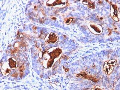 Immunohistochemistry-Paraffin: CEACAM5/CD66e Antibody (C66/1260) - IHC-Prediluted [NBP2-48043]