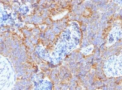 Immunohistochemistry-Paraffin: CEACAM5/CD66e Antibody (C66/1291) - Azide and BSA Free [NBP2-54429]