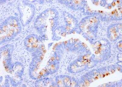 Immunohistochemistry-Paraffin: CEACAM5/CD66e Antibody (C66/1291) [NBP2-53350]