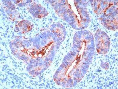 Immunohistochemistry-Paraffin: CEACAM5/CD66e Antibody (C66/195) - Azide and BSA Free [NBP2-47973]