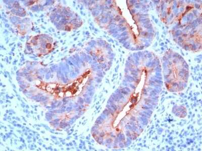 Immunohistochemistry-Paraffin: CEACAM5/CD66e Antibody (C66/195) [NBP2-44897]