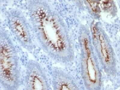 Immunohistochemistry-Paraffin: CEACAM5/CD66e Antibody (C66/261) - Azide and BSA Free [NBP2-34586]