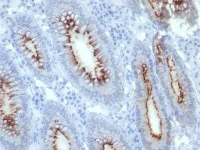 Immunohistochemistry-Paraffin: CEACAM5/CD66e Antibody (C66/261) - IHC-Prediluted [NBP2-44899]