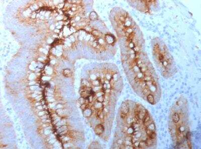 Immunohistochemistry-Paraffin: CEACAM5/CD66e Antibody (C66/261) [NBP2-33010]