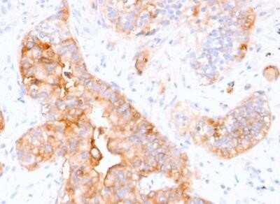 Immunohistochemistry-Paraffin: CEACAM5/CD66e Antibody (CEA31) - Azide and BSA Free [NBP2-34594]