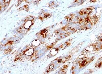 Immunohistochemistry-Paraffin: CEACAM5/CD66e Antibody (CEA31) - Azide and BSA Free [NBP2-34594]