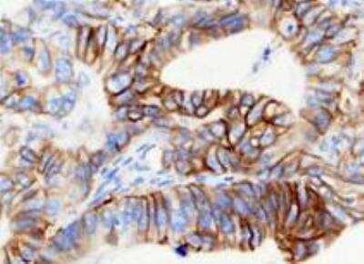 Immunohistochemistry-Paraffin: CEACAM5/CD66e Antibody (CEA31) - Azide and BSA Free [NBP2-34594]