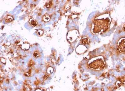 Immunohistochemistry-Paraffin: CEACAM5/CD66e Antibody (CEA31) - IHC-Prediluted [NBP2-44901]