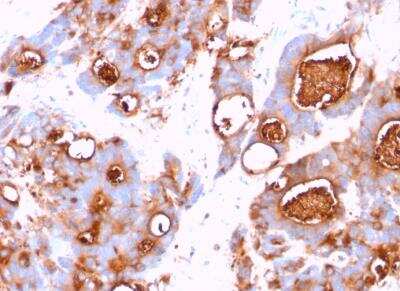 Immunohistochemistry-Paraffin: CEACAM5/CD66e Antibody (CEA31) [NBP2-33012]
