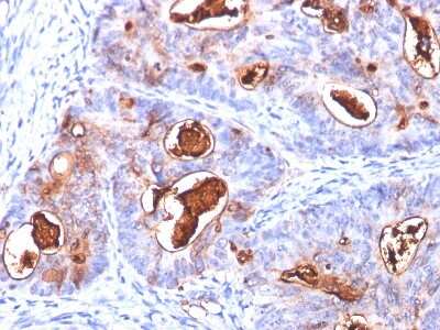 Immunohistochemistry-Paraffin: CEACAM5/CD66e Antibody (COL-1 + CEA31 + C66/261) - Azide and BSA Free [NBP2-34597]