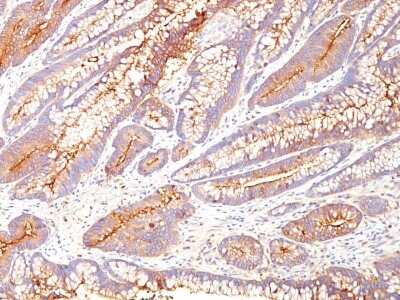 Immunohistochemistry-Paraffin: CEACAM5/CD66e Antibody (COL-1) - Azide and BSA Free [NBP3-05767]