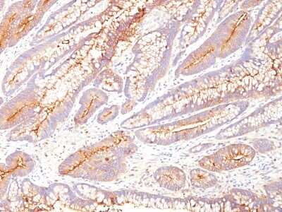 Immunohistochemistry-Paraffin: CEACAM5/CD66e Antibody (COL-1) - IHC-Prediluted [NBP3-05768]