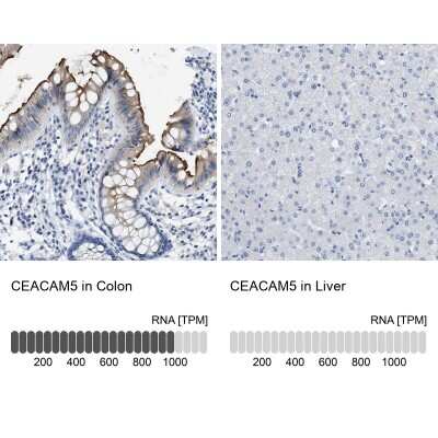 Immunohistochemistry-Paraffin: CEACAM5/CD66e Antibody [NBP1-85742]