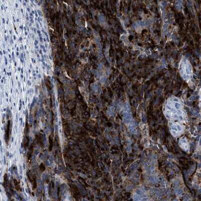 Immunohistochemistry-Paraffin: CEACAM5/CD66e Antibody [NBP1-85742]