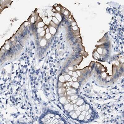 Immunohistochemistry-Paraffin: CEACAM5/CD66e Antibody [NBP1-85742]