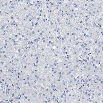 Immunohistochemistry-Paraffin: CEACAM5/CD66e Antibody [NBP1-85742]