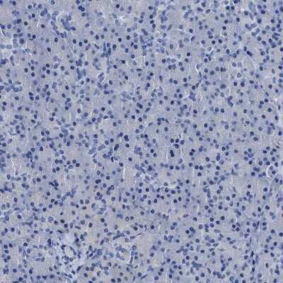 Immunohistochemistry-Paraffin: CEACAM5/CD66e Antibody [NBP1-85742]
