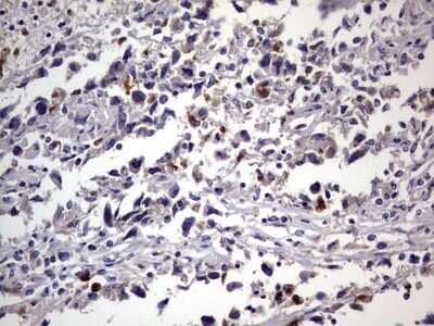 Immunohistochemistry: CEACAM5/CD66e Antibody (OTI3D8) - Azide and BSA Free [NBP2-70407]