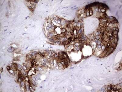 Immunohistochemistry: CEACAM5/CD66e Antibody (OTI3D8) - Azide and BSA Free [NBP2-70407]