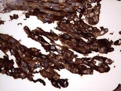 Immunohistochemistry: CEACAM5/CD66e Antibody (OTI3D8) - Azide and BSA Free [NBP2-70407]