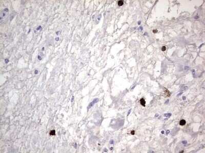 Immunohistochemistry: CEACAM5/CD66e Antibody (OTI3D8) - Azide and BSA Free [NBP2-70407]