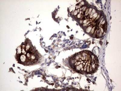 Immunohistochemistry: CEACAM5/CD66e Antibody (OTI3D8) - Azide and BSA Free [NBP2-70407]