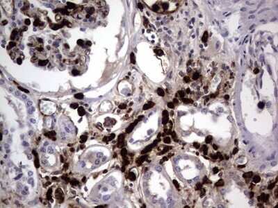 Immunohistochemistry: CEACAM5/CD66e Antibody (OTI3D8) - Azide and BSA Free [NBP2-70407]