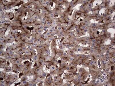 Immunohistochemistry: CEACAM5/CD66e Antibody (OTI3D8) - Azide and BSA Free [NBP2-70407]