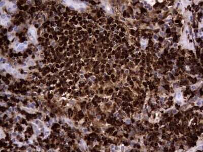 Immunohistochemistry: CEACAM5/CD66e Antibody (OTI3D8) - Azide and BSA Free [NBP2-70407]