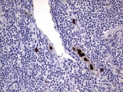 Immunohistochemistry: CEACAM5/CD66e Antibody (OTI3D8) - Azide and BSA Free [NBP2-70407]
