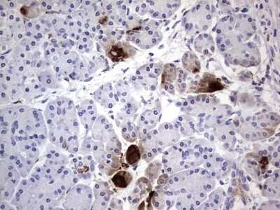 Immunohistochemistry: CEACAM5/CD66e Antibody (OTI3D8) - Azide and BSA Free [NBP2-70407]