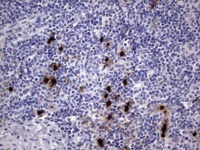 Immunohistochemistry: CEACAM5/CD66e Antibody (OTI3D8) - Azide and BSA Free [NBP2-70407]